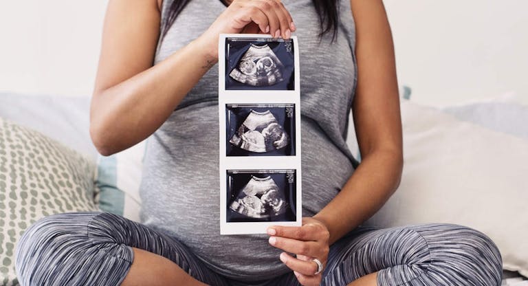 This is the first picture of my bundle of joy