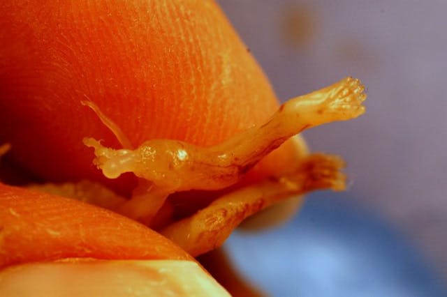 An aborted fetus’s leg with thigh bone protruding. 8 weeks gestation. Photo courtesy of prolifesociety.com and imagesofabortion.com. abortion