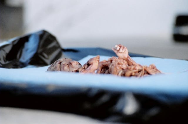 Baby aborted at six months These 7 celebrities fight to protect animals, but not human lives image