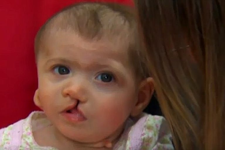 disabled baby unwanted