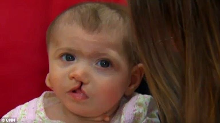 disabled baby unwanted