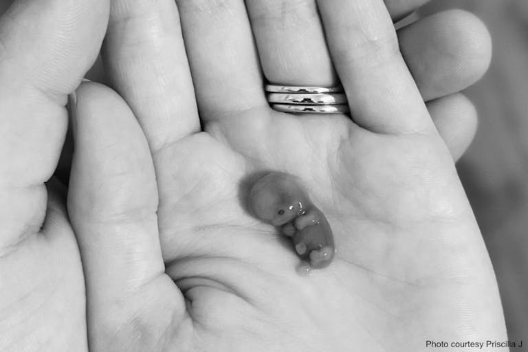 9 week miscarried baby 2 – mom priscilla