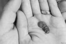 9 week miscarried baby 2 – mom priscilla
