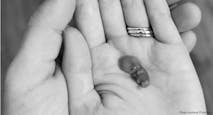 9 week miscarried baby 2 – mom priscilla