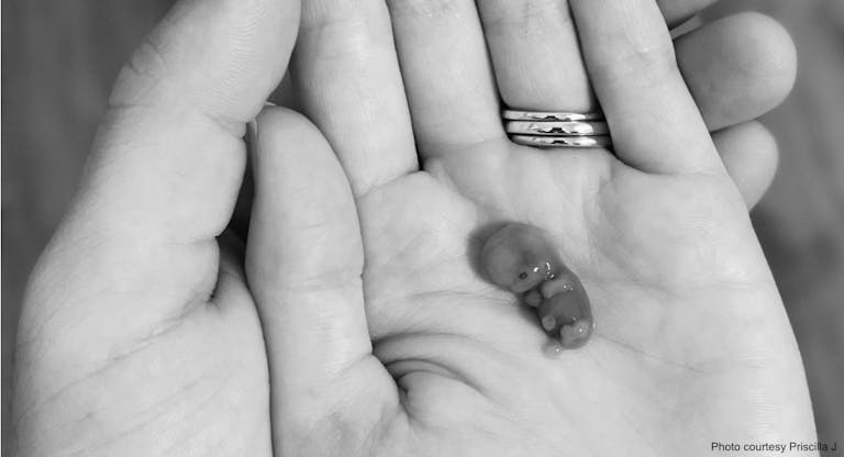 9 week miscarried baby 2 – mom priscilla