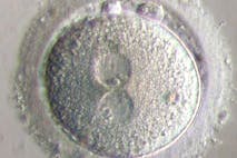 Zygote-image