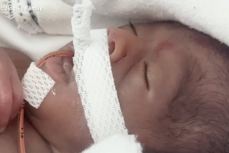 sienna preemie 24 weeks