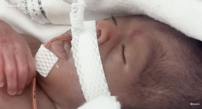 sienna preemie 24 weeks