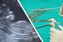 Planned Parenthood