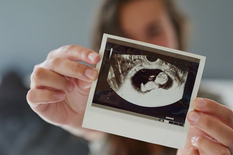 pregnancy center, ultrasound, abortion, abortion pill