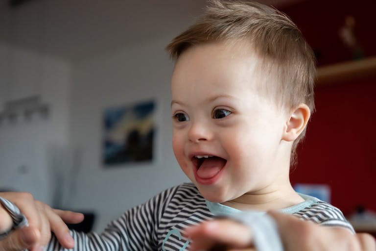 Down syndrome, northern ireland, abortion, disabilities