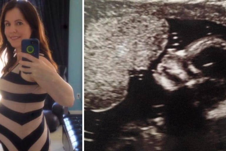 abortion, life of the mother, Naomi Bakker