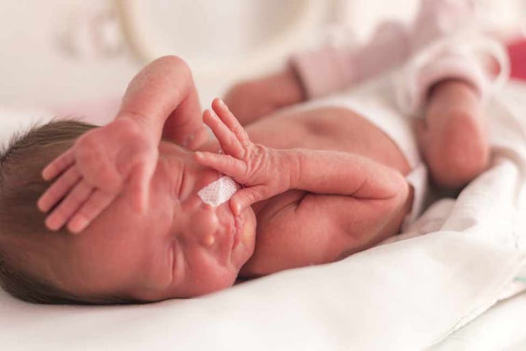 abortionists, preemie, born alive, San Francisco