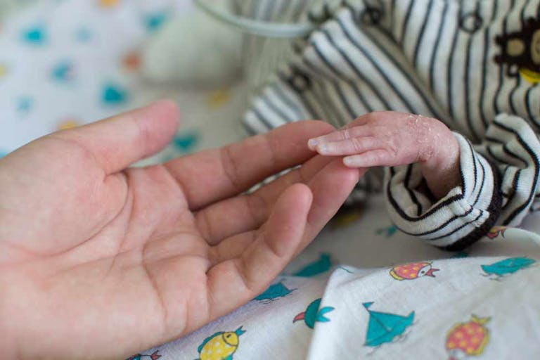 Trump, newborn, Virginia, preemie, born alive, abortion