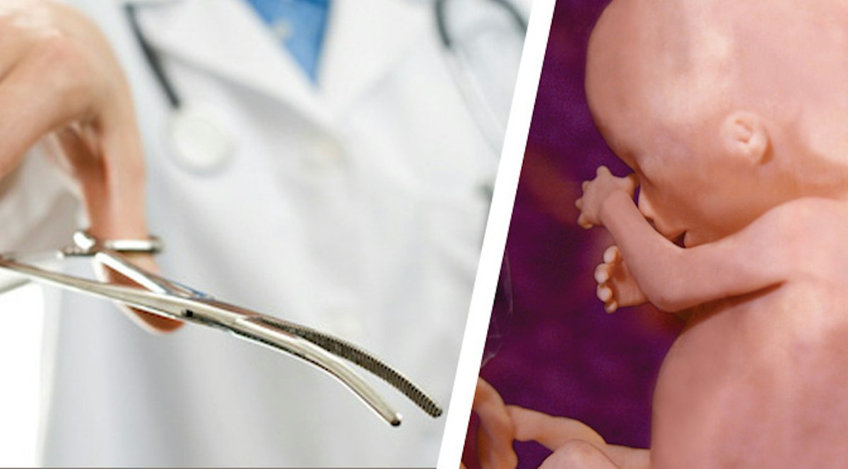University of Washington expanding abortion training program to include ...