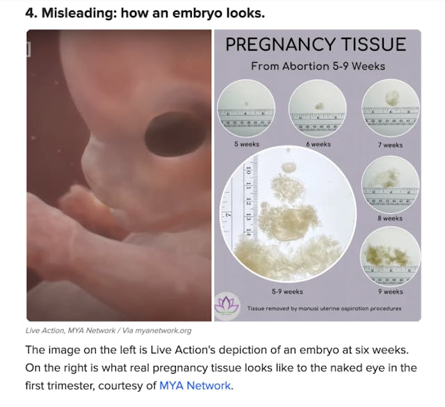 BuzzFeed’s attempt to discredit ‘Baby Olivia’ prenatal development video is the weakest yet image