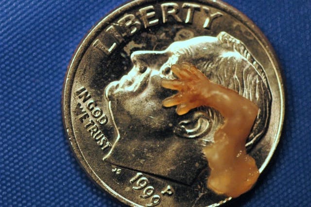 Hand and arm of aborted baby killed at Woman’s Choice abortion clinic. Whole arm fits on a dime. 7 weeks. Photo courtesy of prolifesociety.com and imagesofabortion.com. Hand and arm of aborted baby killed at Woman’s Choice abortion clinic. Whole arm fits on a dime. 7 weeks. Photo courtesy of prolifesociety.com and imagesofabortion.com.
