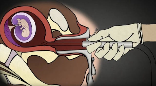 New study finds preborn babies may feel pain in the first trimester image