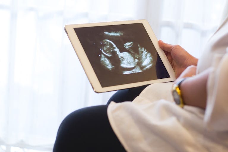 anencephaly, northern ireland,, Arizona, abortion, Biden