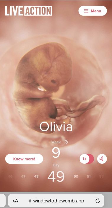 Window to the Womb, 9 weeks (49 days)