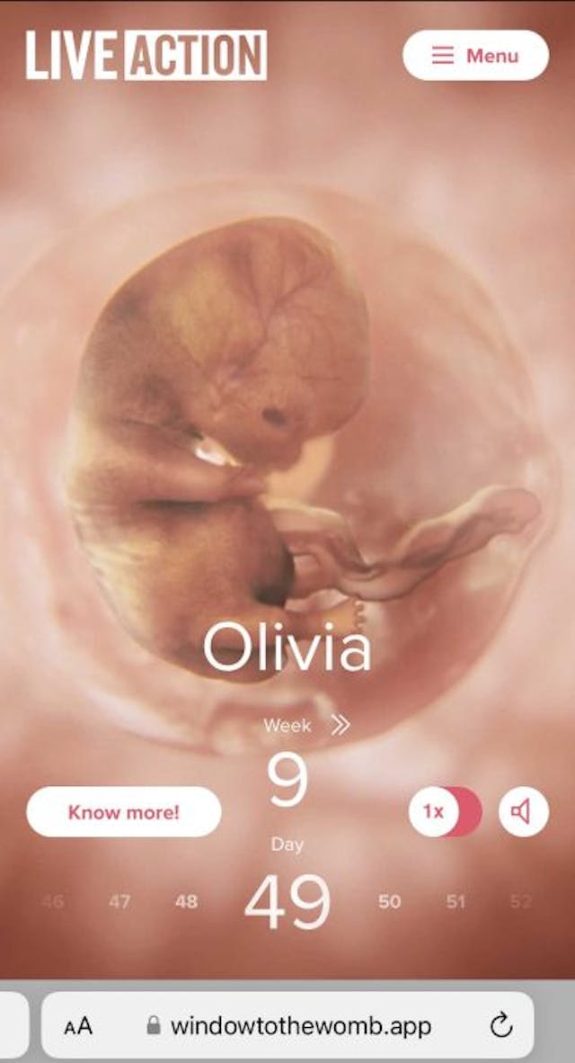 Window to the Womb, 9 weeks (49 days) Window to the Womb, 9 weeks (49 days)