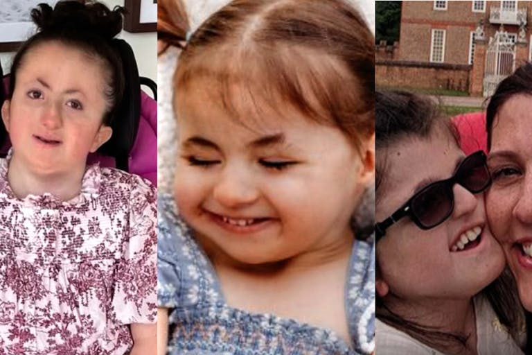children trisomy 18