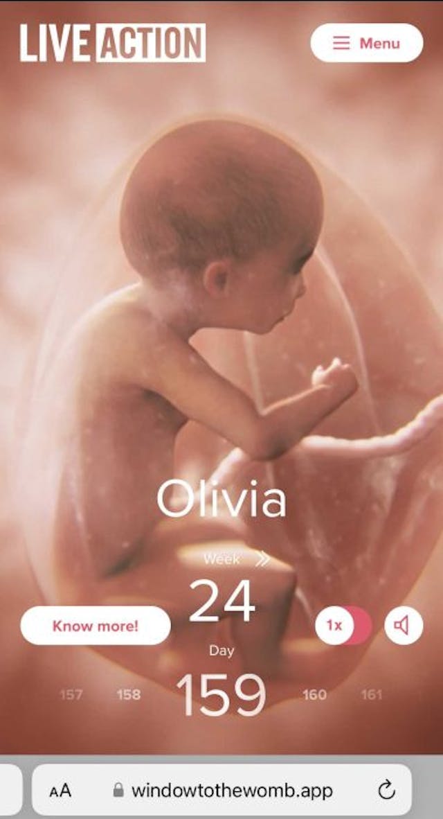 Window to the Womb, 24 weeks (159 days) Window to the Womb, 24 weeks (159 days)