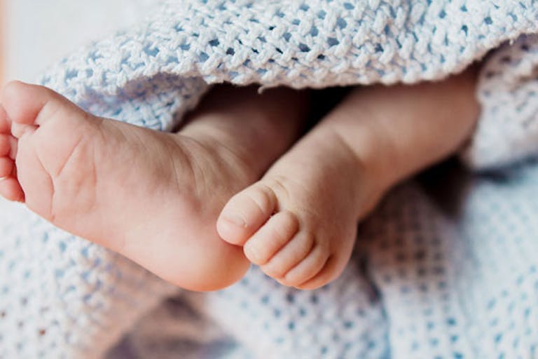 anencephaly, Down syndrome, teen mom