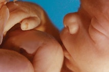 unborn-human-fetus