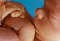 unborn-human-fetus