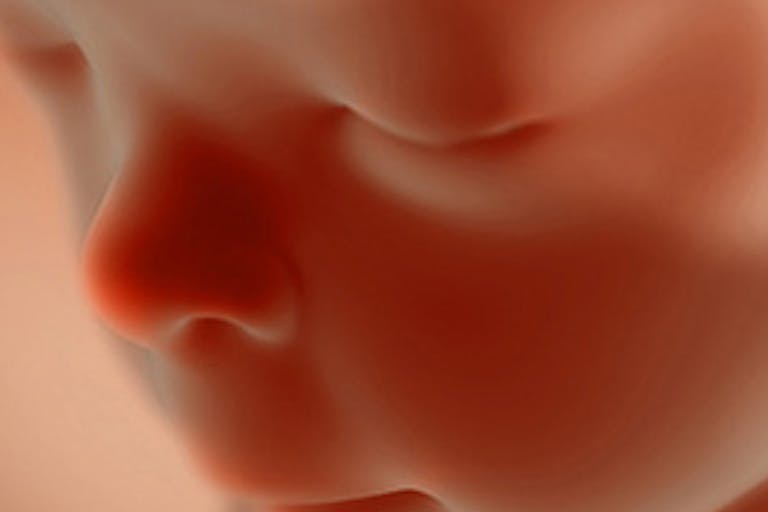 20-weeks-pregnant-baby