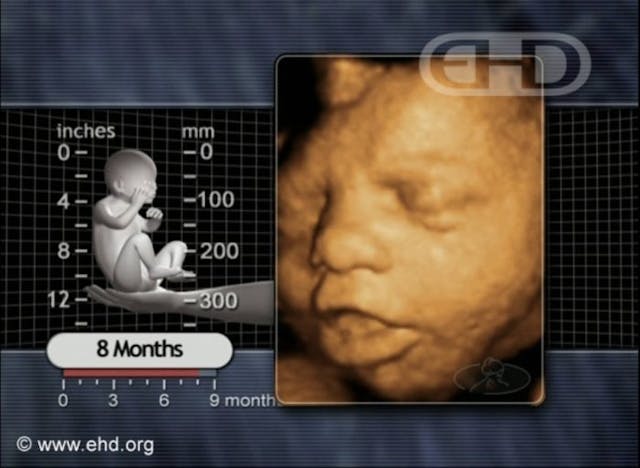 8 months (ehd.org WATCH: Choosing life after rape, Emily’s story shows the impact of adoption image