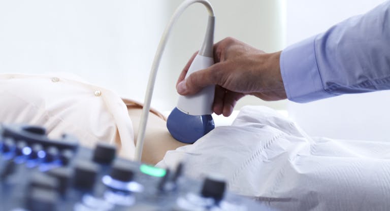 Pregnancy ultrasound scan
