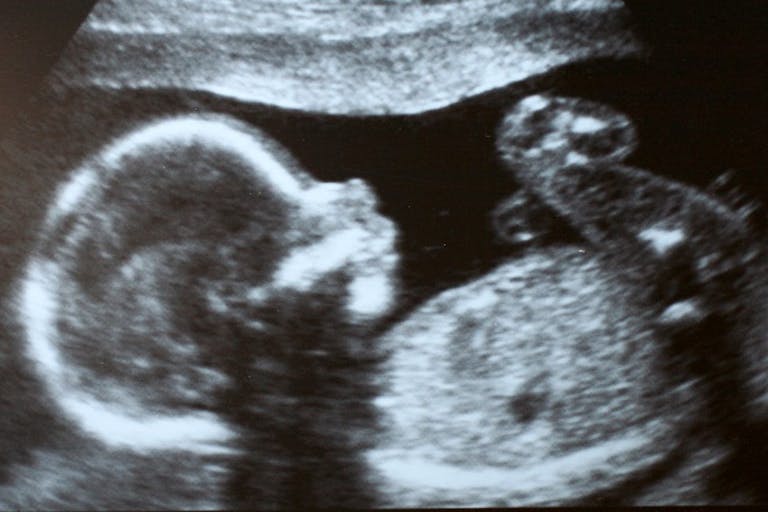 Mexico, abortion, ultrasound, prenatal diagnosis, Virginia, poll