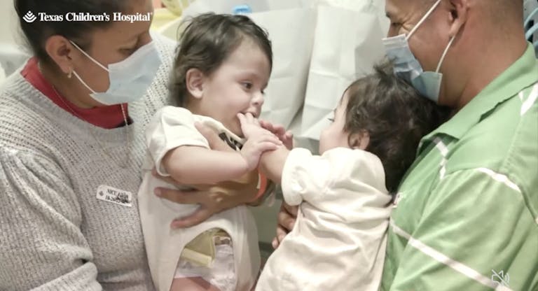 twins conjoined go home villalobos barrera