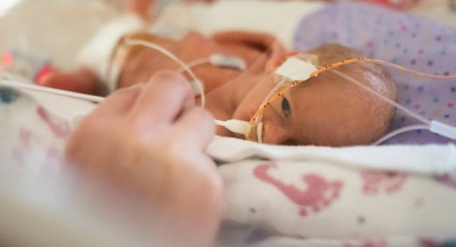 Female baby in NICU – 29 Weeks is in isolette / incubator with eye protection covering eyes gets milk fed by syringe / mother preemie, premature birth, pacemaker, premature