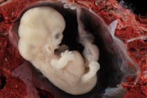heart, embryo, heartbeat abortion bill, embryo, science