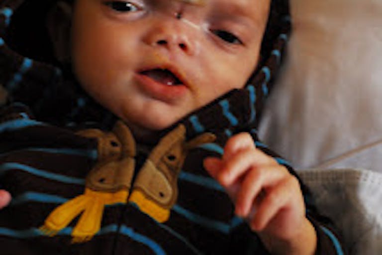 Dominic after surgery