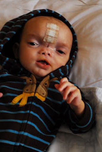 Dominic after surgery