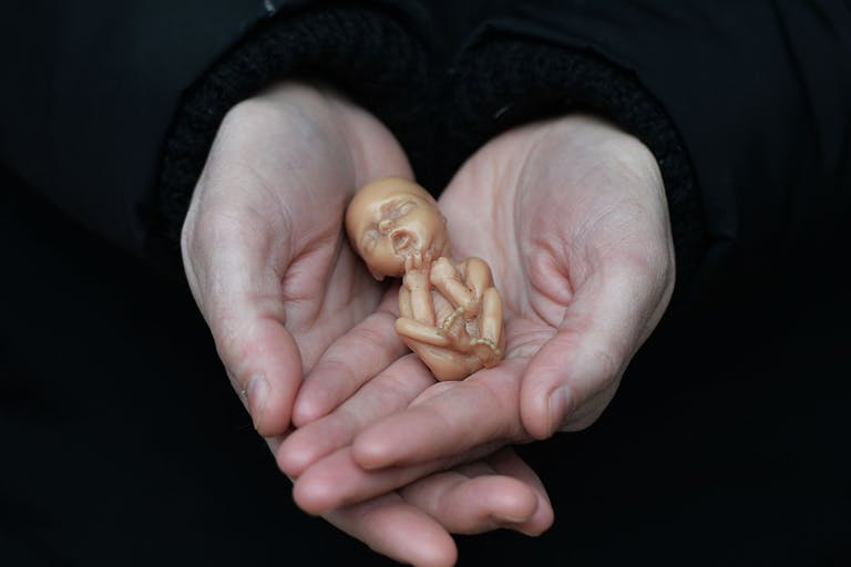 12-week fetal model, Northern Ireland, UK, abortion