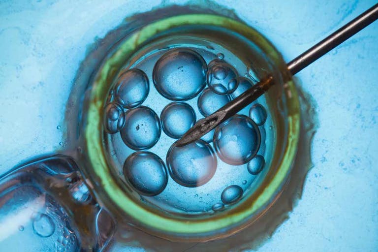 IVF, embryo