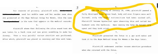 Hope Medical abortion lawsuit partially aborted baby limbs missing Hope Medical abortion lawsuit partially aborted baby limbs missing
