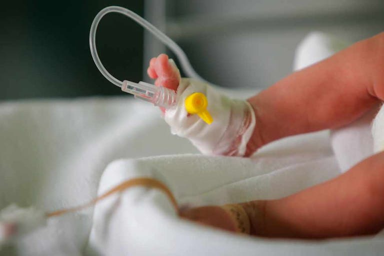 second trimester, abortion, premature