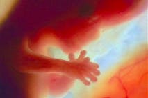 A preborn child at 12 weeks gestation. first trimester, pro-life, abortion