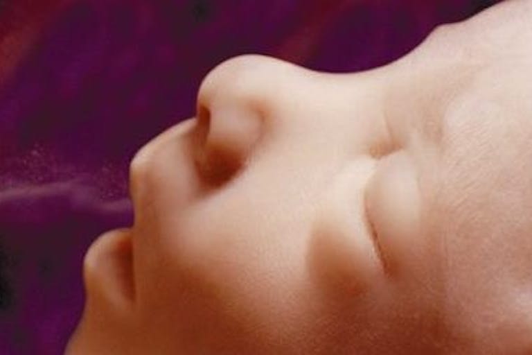 unbornbaby16w-02 (1)