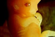 7weekfetus