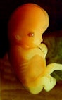 7weekfetus