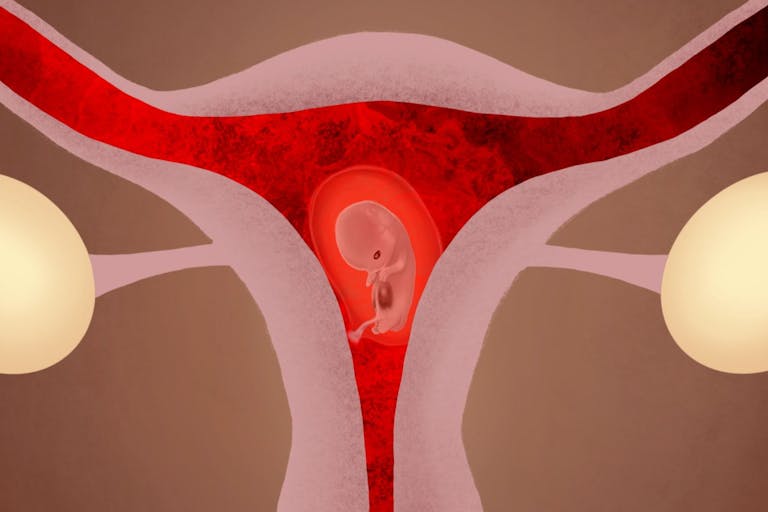 abortion pill screenshot