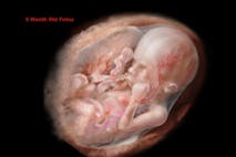 prolife, miracle, fetus, unborn child, TED