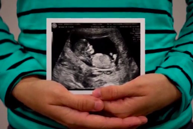 roe turns 41, ultrasound, mother